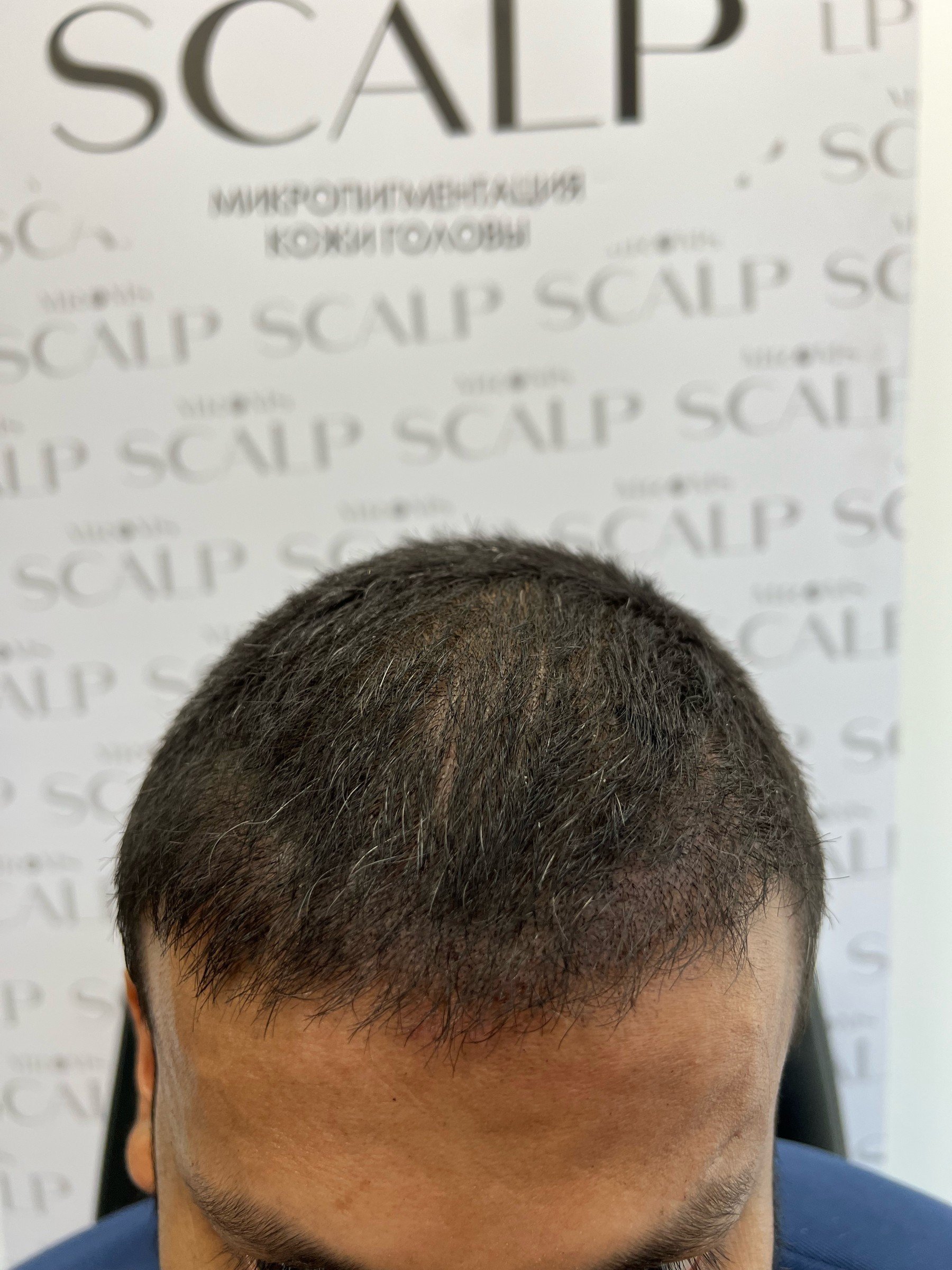 После