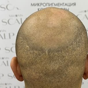 Иордания: До